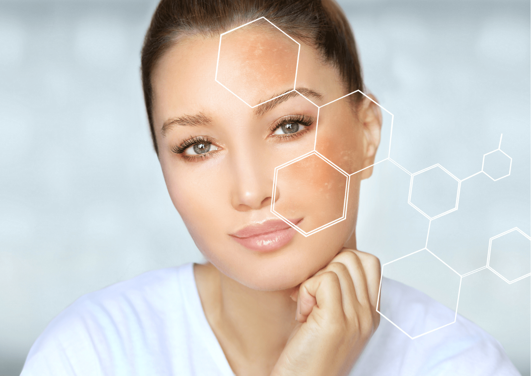 Amazing Alpha Arbutin Benefits for Skin