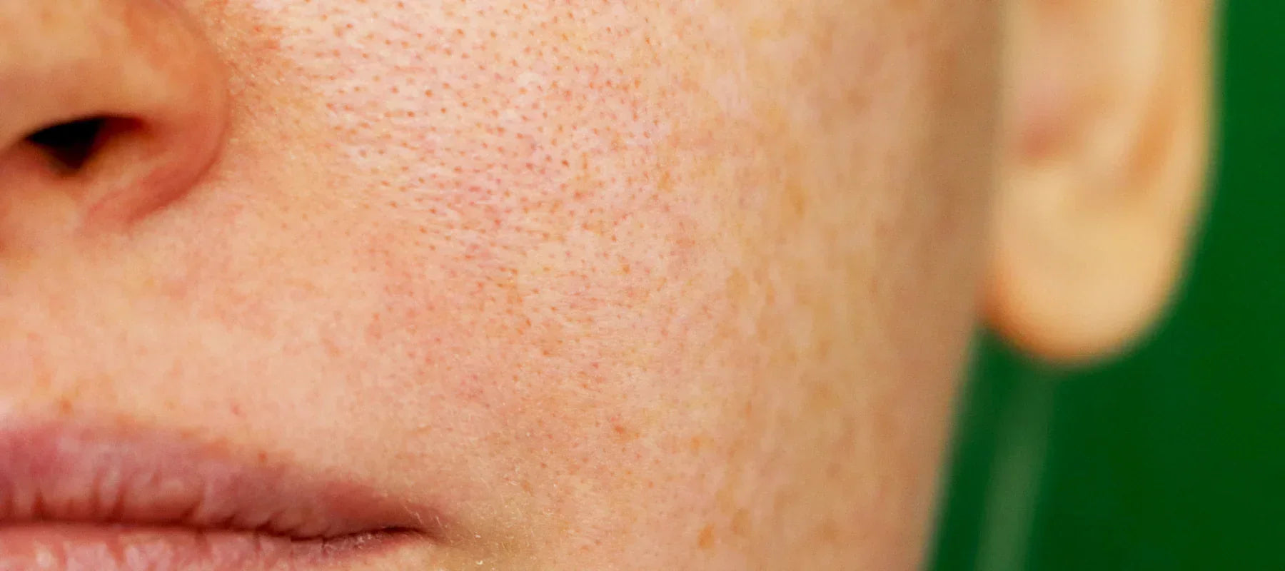 How to Remove Sunscreen From Face