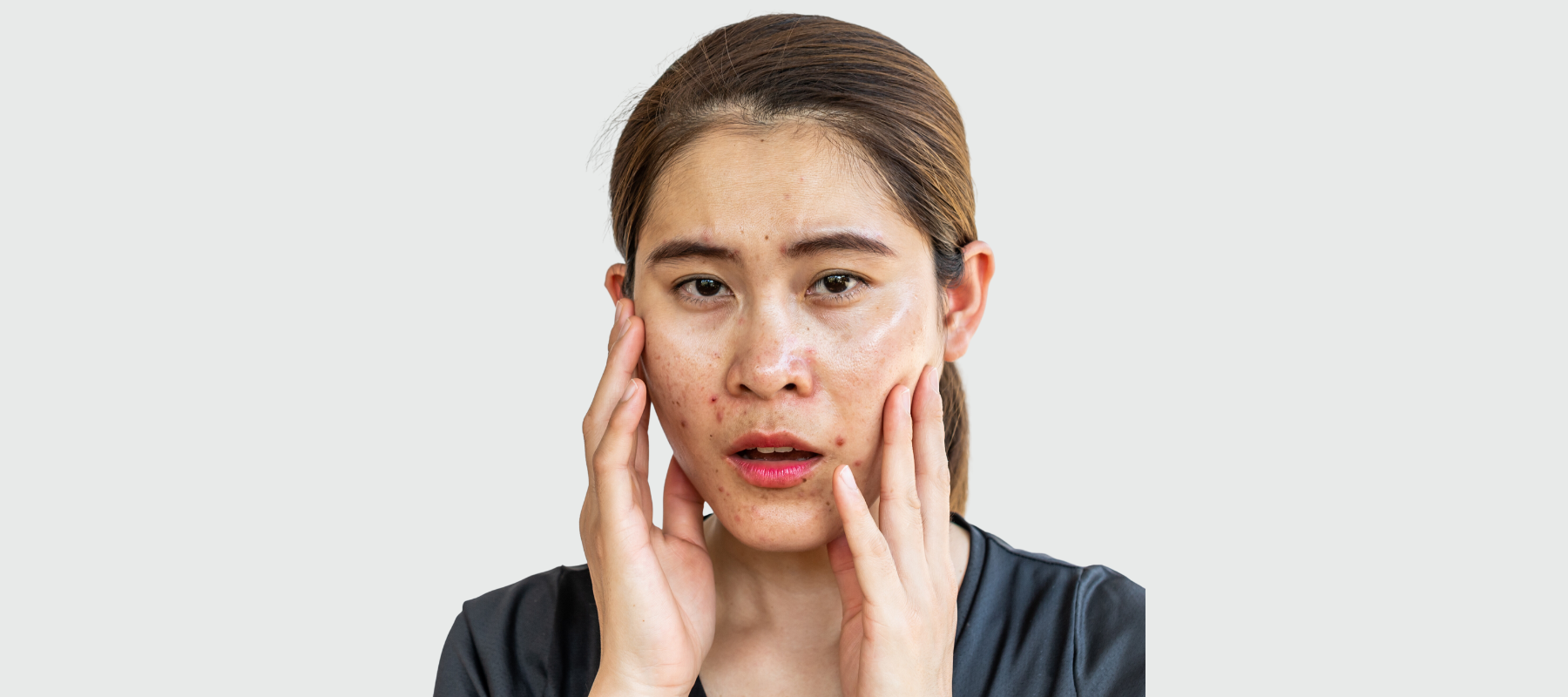 Comprehensive guide to the best Face Moisturizer for Oily Skin