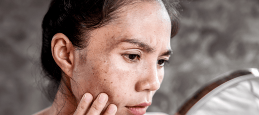 Depicting potential factors causing skin darkening
