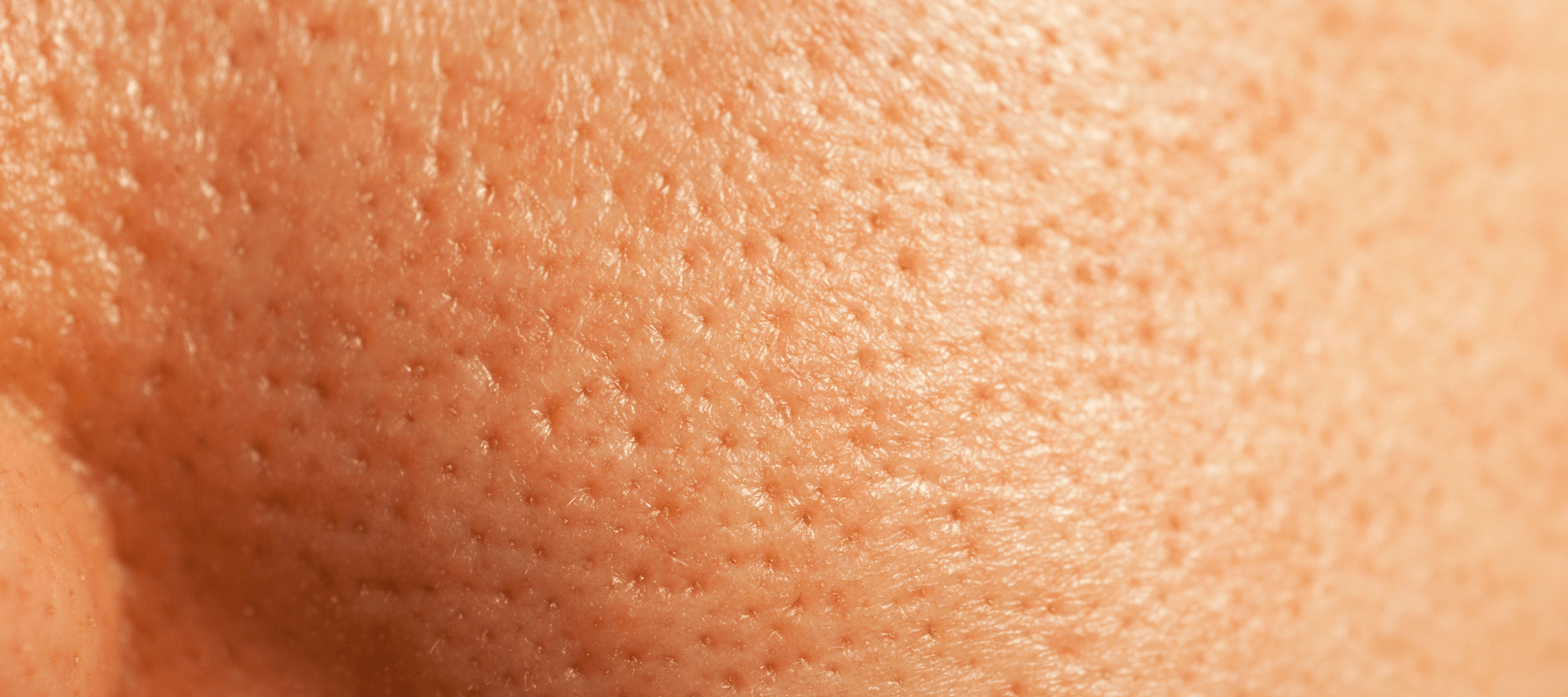 Exploring the Solutions for Uneven Skin Tone on Face