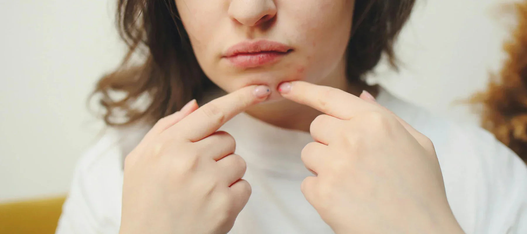 How to reduce pimple swelling