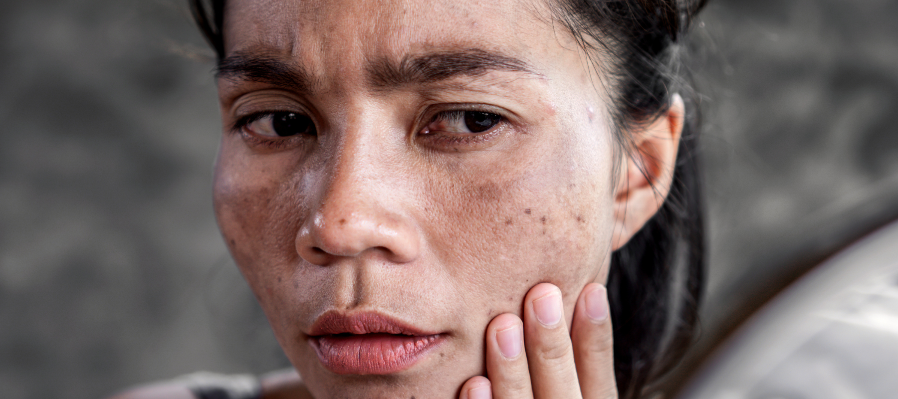 Expert advice on nurturing and repairing damaged skin barriers