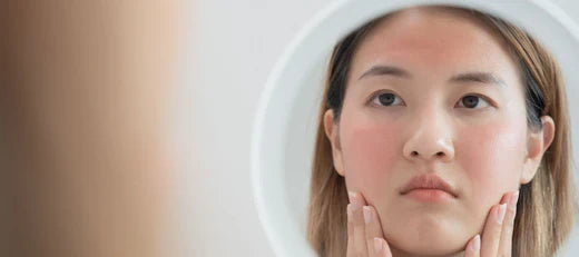 Dry and sensitive skin on face