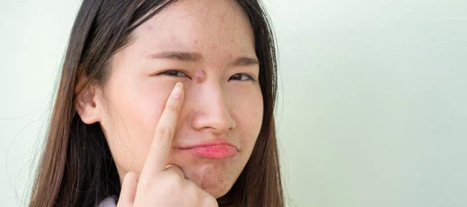 Inflamed skin on face