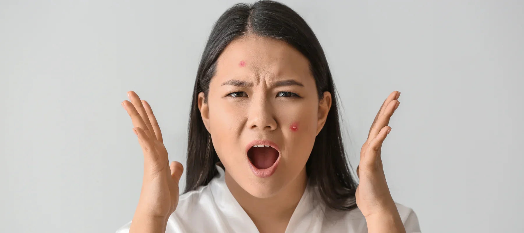 What is the difference between pimples and zits