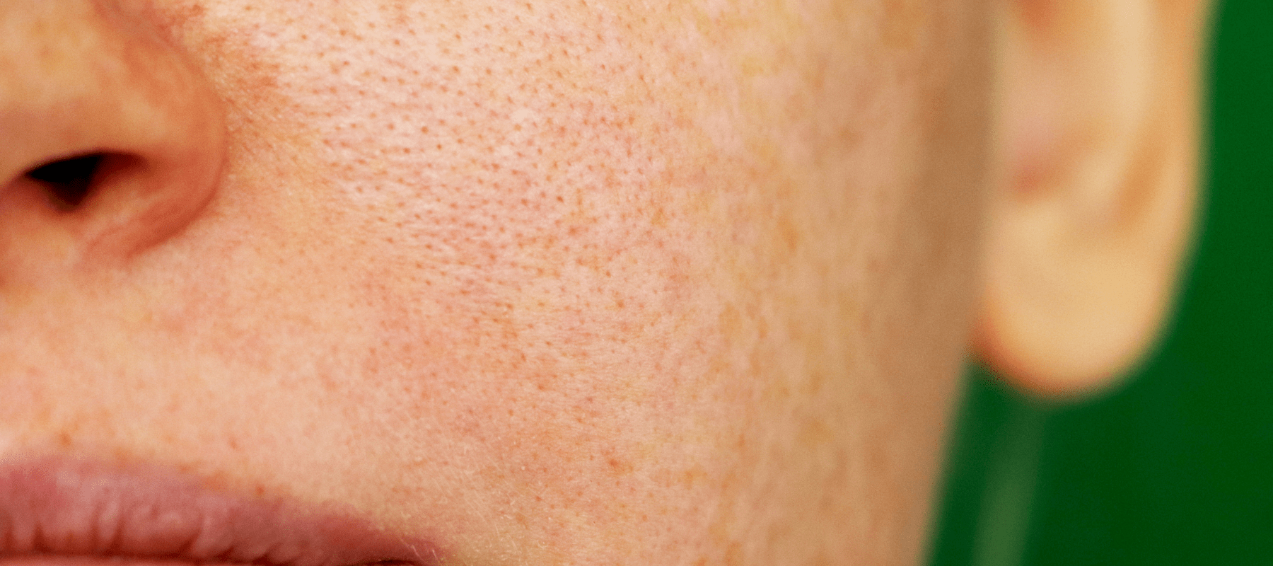 Skincare product to reduce open pores on her face