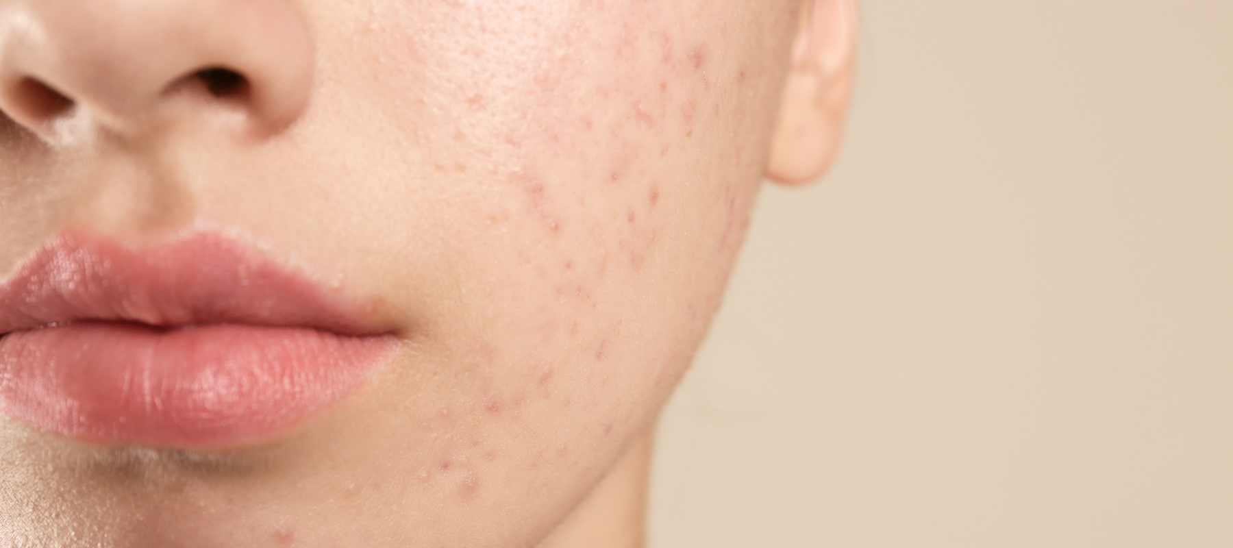 The causes and treatments for facial skin pores