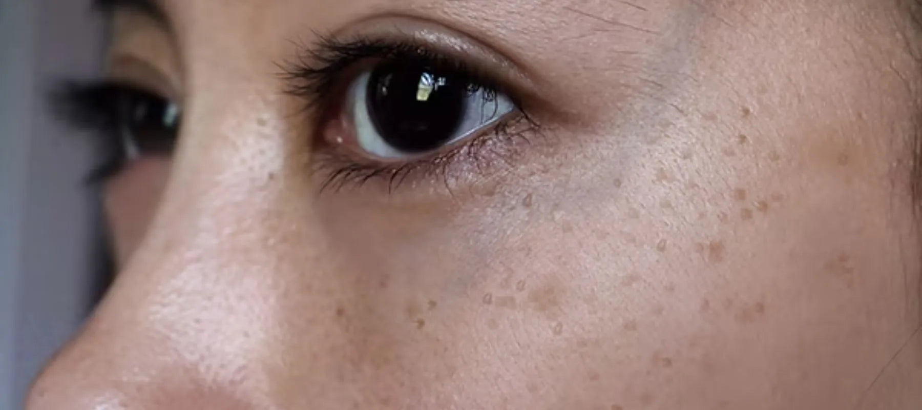 Tiny black dots on face