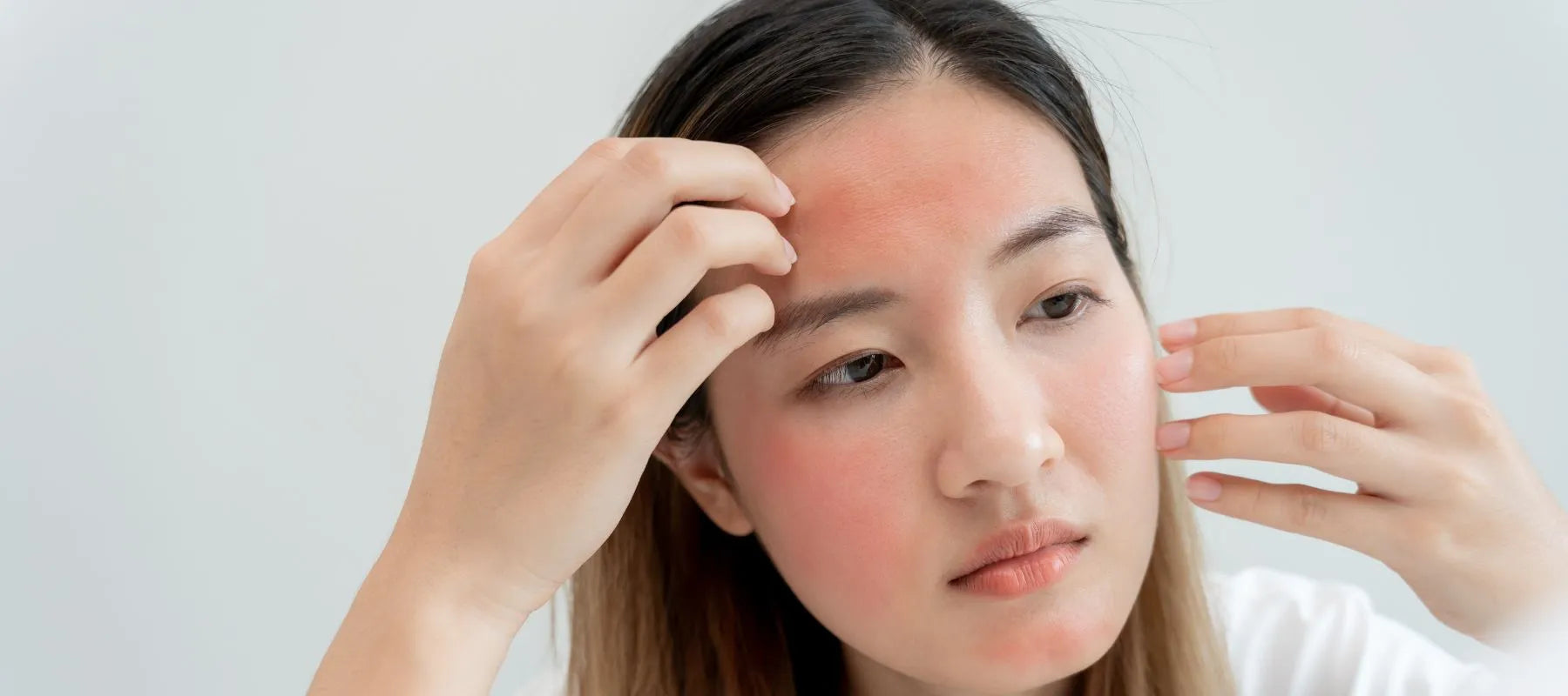 Skin photosensitivity