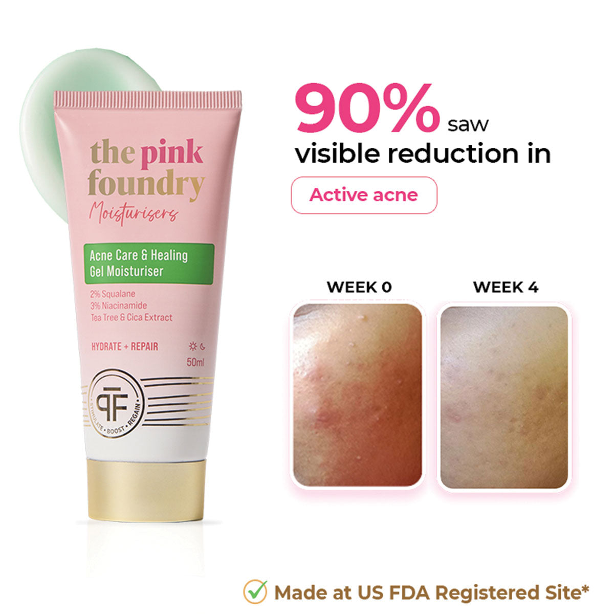 Acne Care & Healing Gel Moisturiser