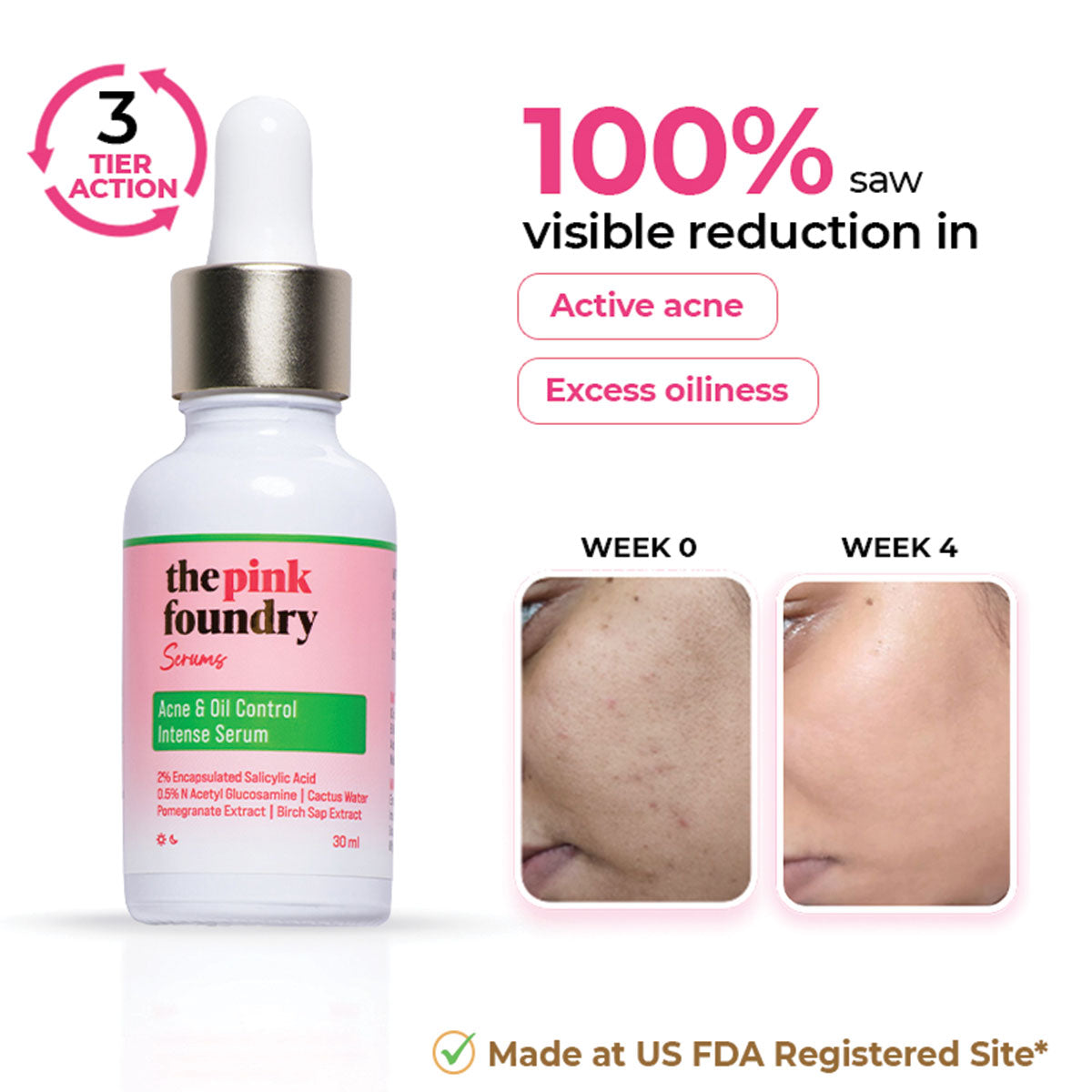 Acne & Oil Control Intense Serum with 2% Salicylic Acid