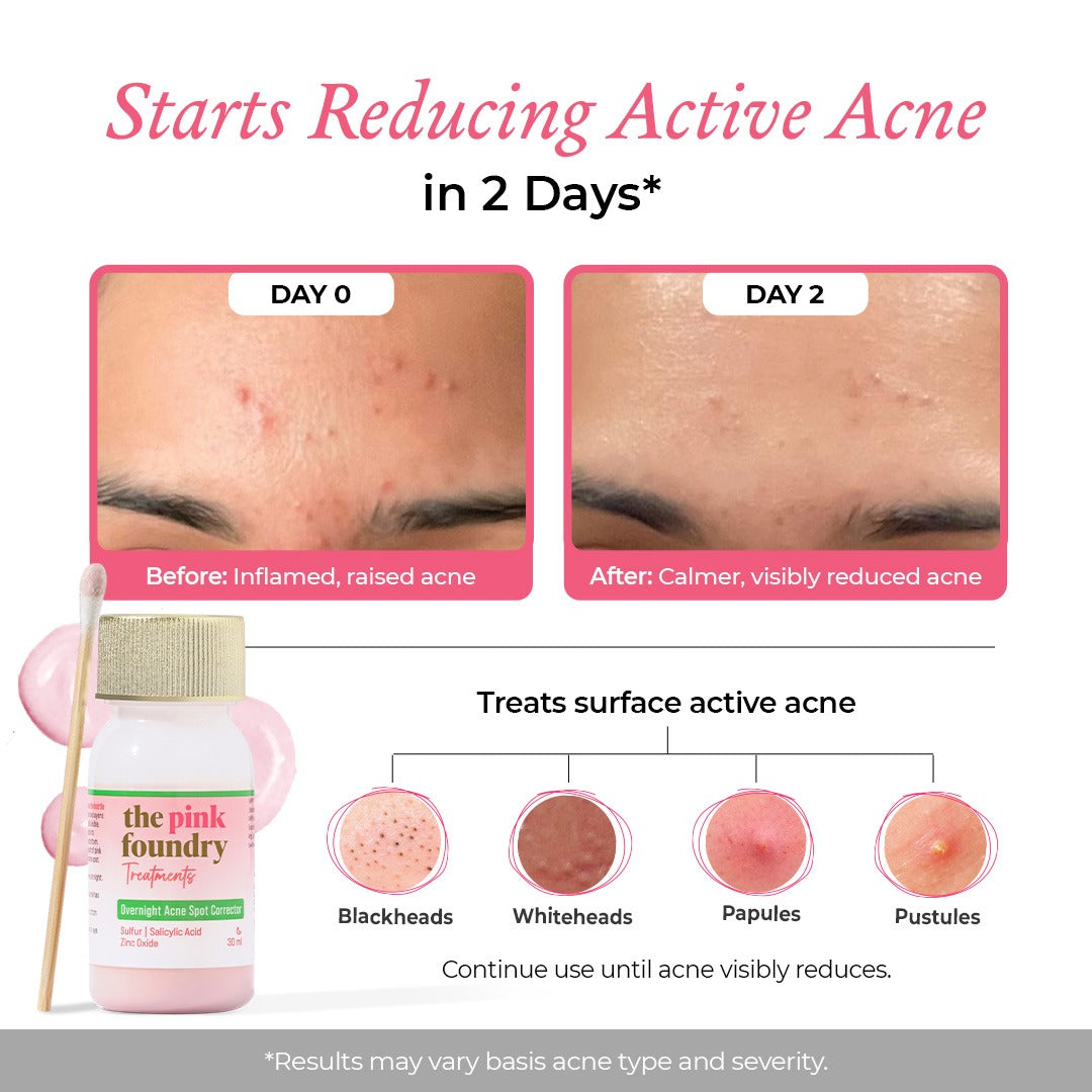 Overnight Acne Spot Corrector for Men