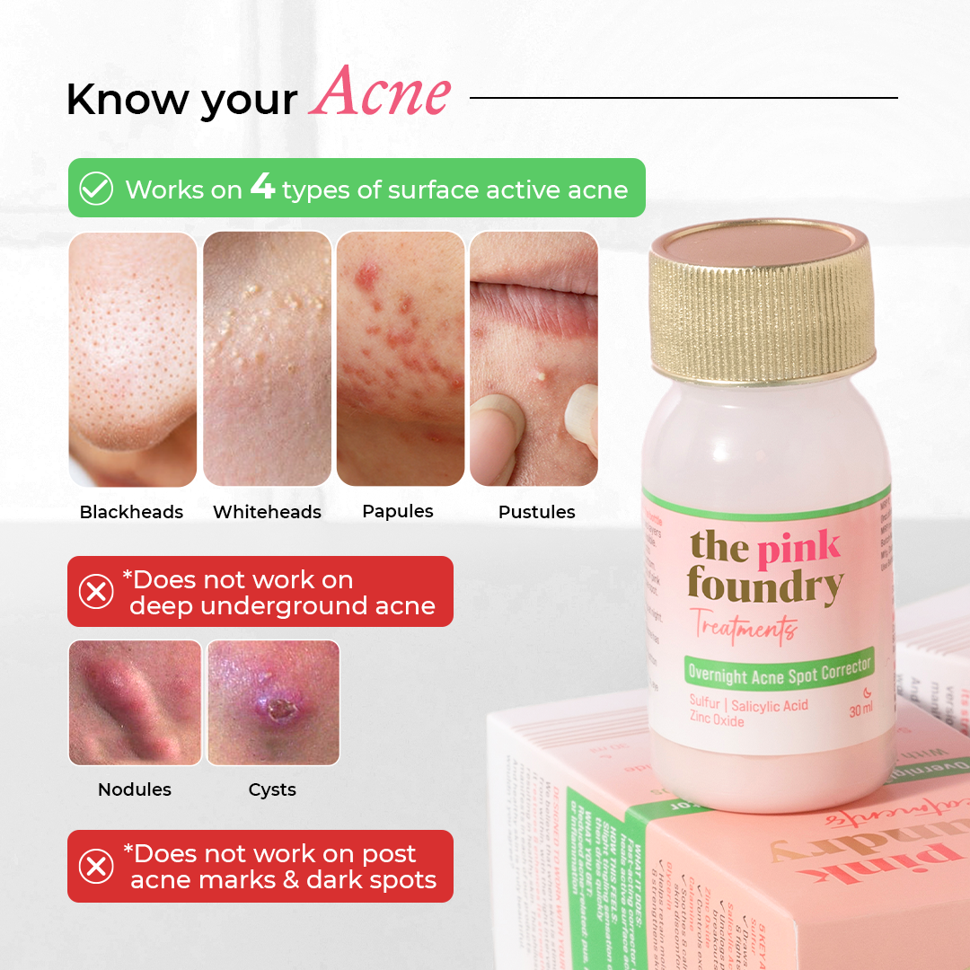 Overnight Acne Spot Corrector 30 ml