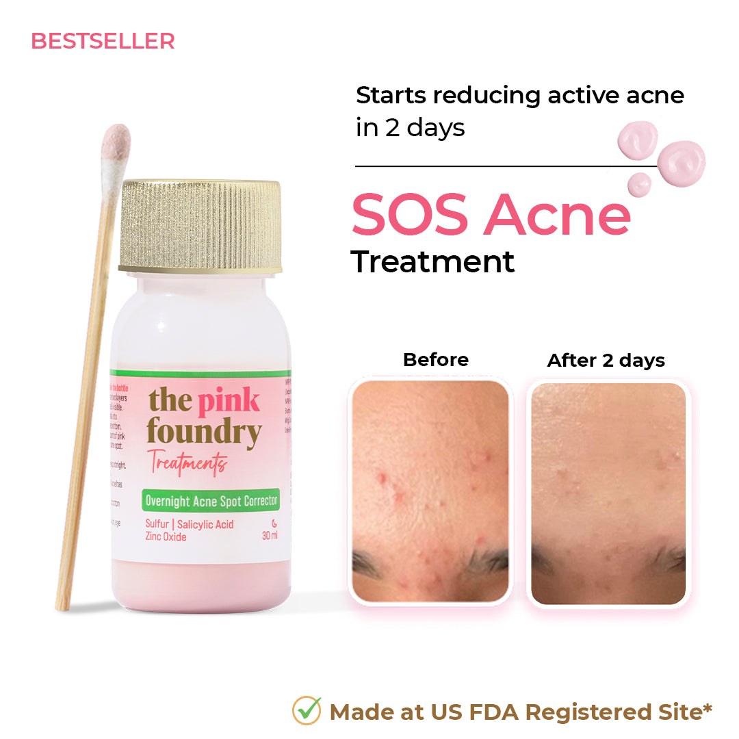 Overnight Acne Spot Corrector