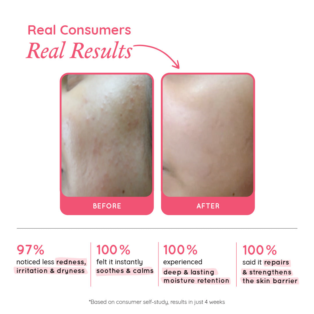 Barrier Repair & Restore Moisturiser
