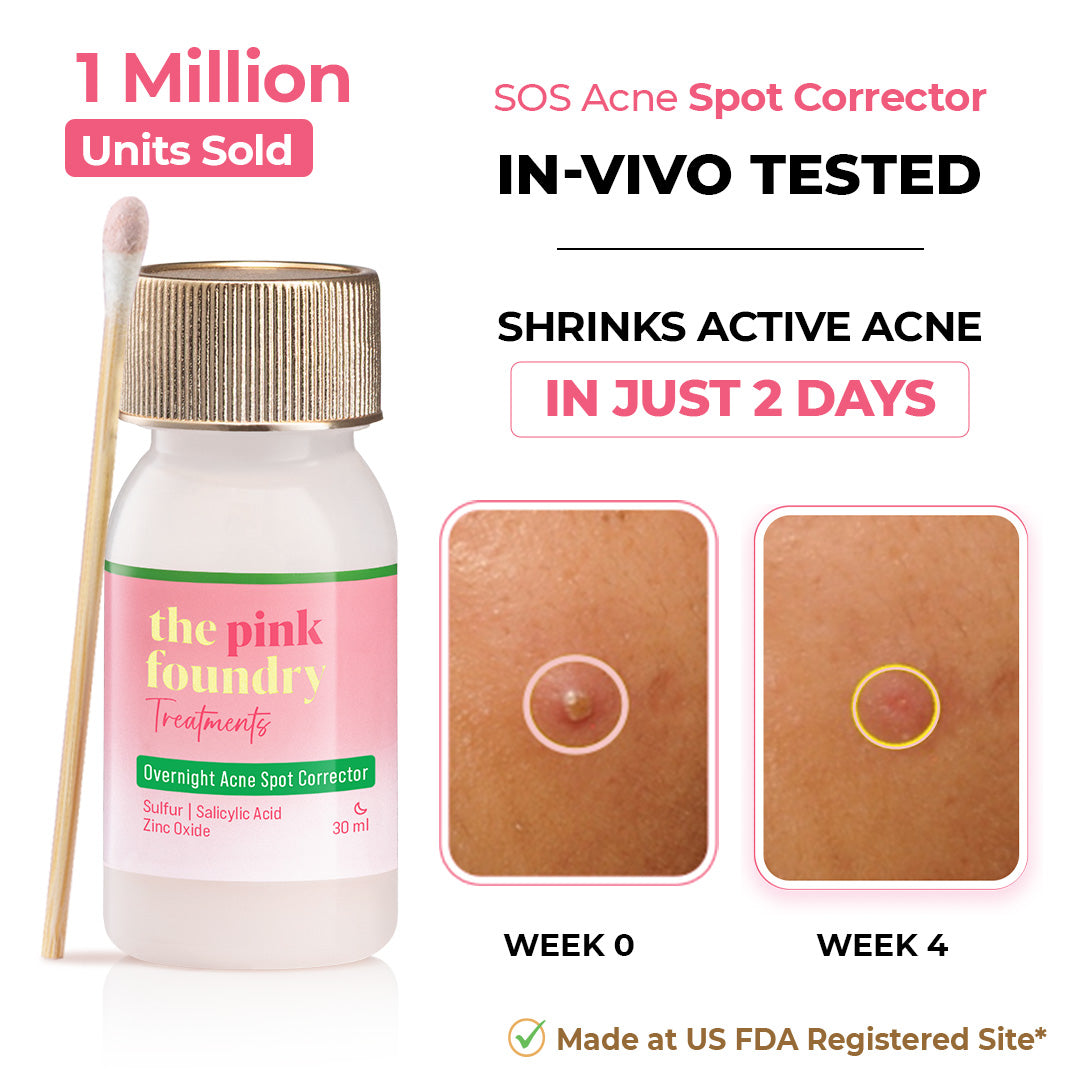 Overnight Acne Spot Corrector