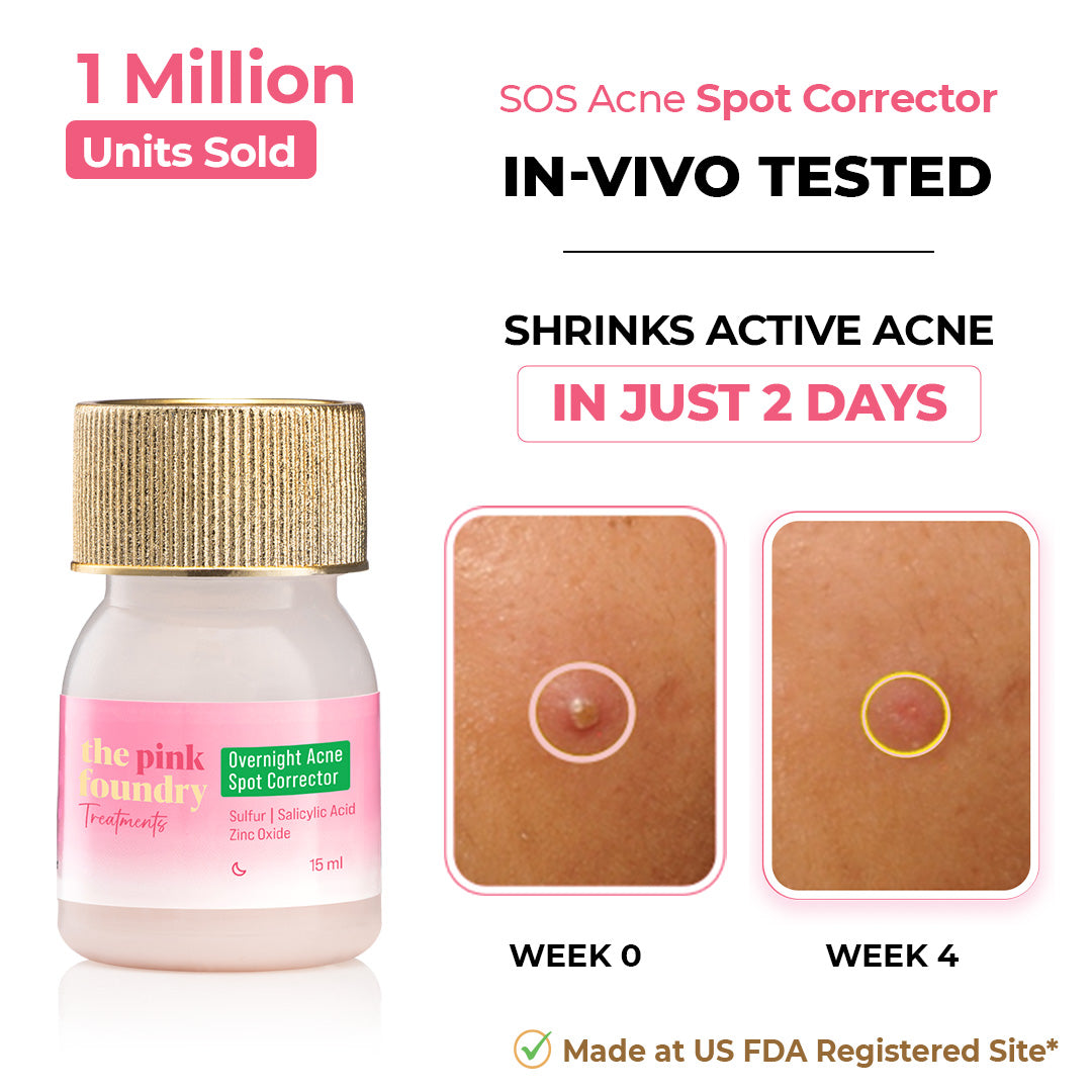 Overnight Acne Spot Corrector