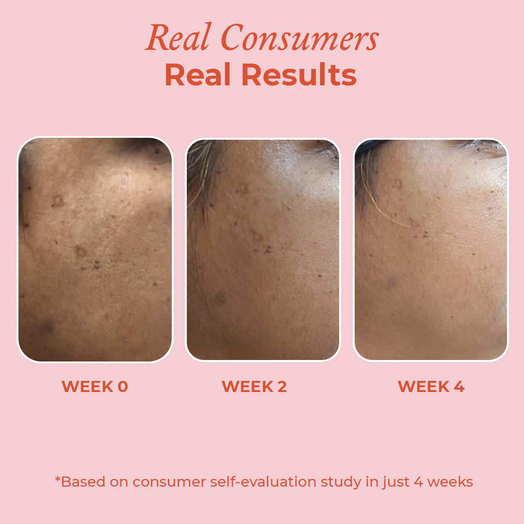 Before and after of 15% Vitamin C Brightening Face Serum