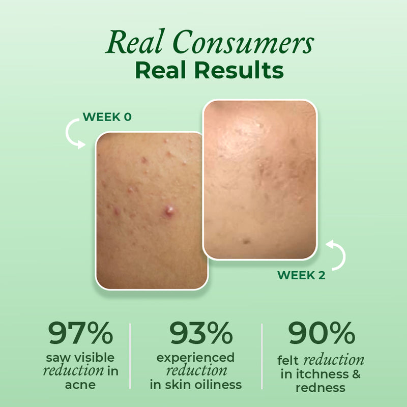 Consumers study results of the acne face wash by The Pink Foundry