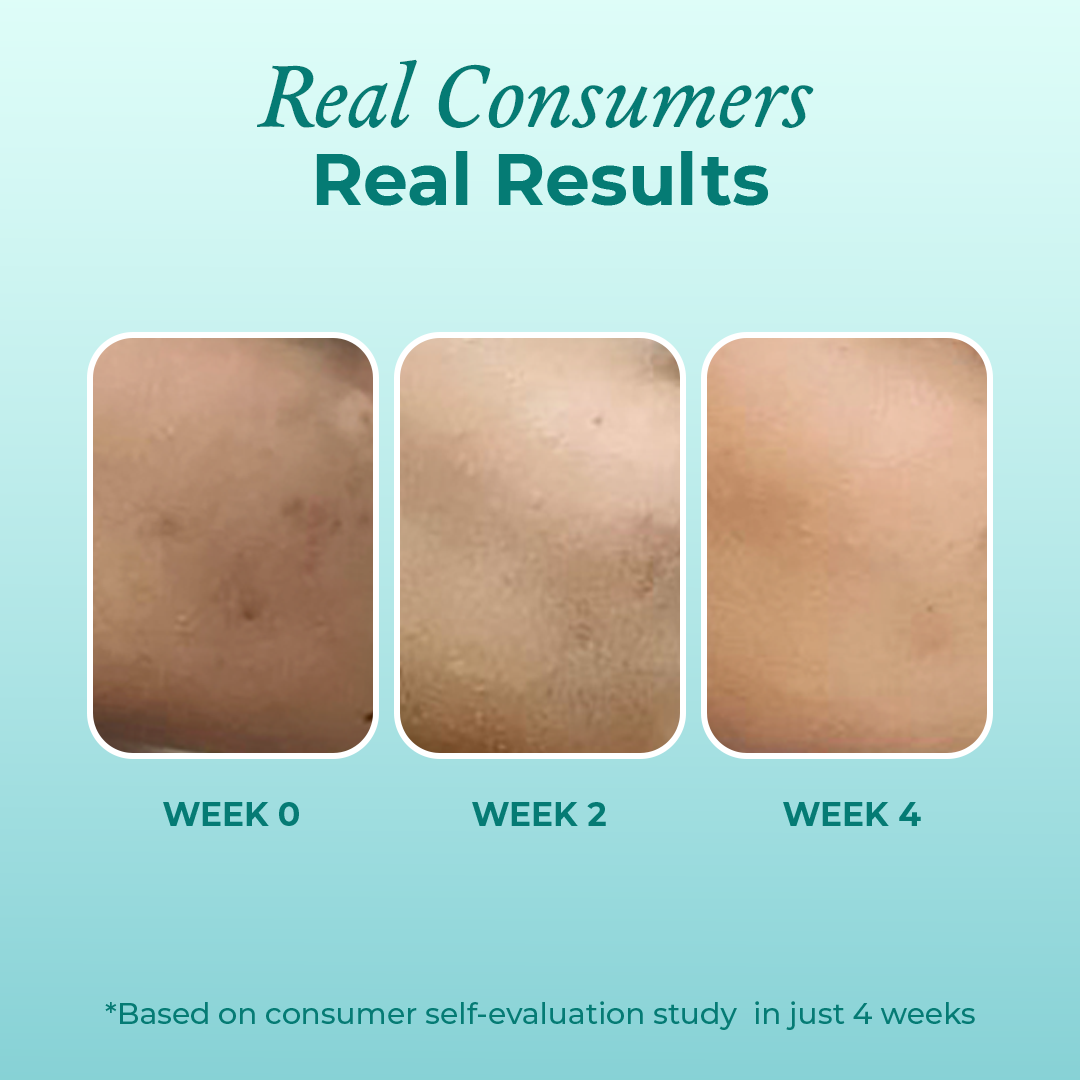 Consumer results after using the mini niacinamide serum from The Pink Foundry