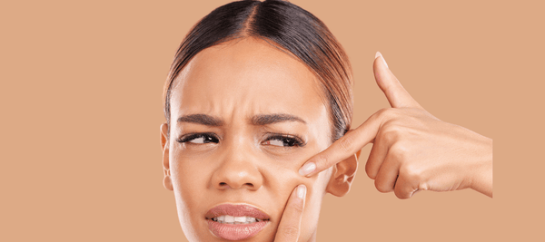 Antibiotics for Acne: How They Work and When to Consider Them