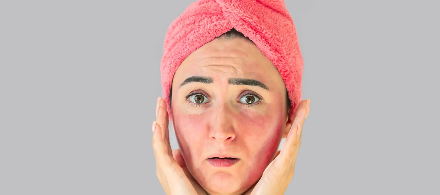 Congested skin meaning, causes, and treatment