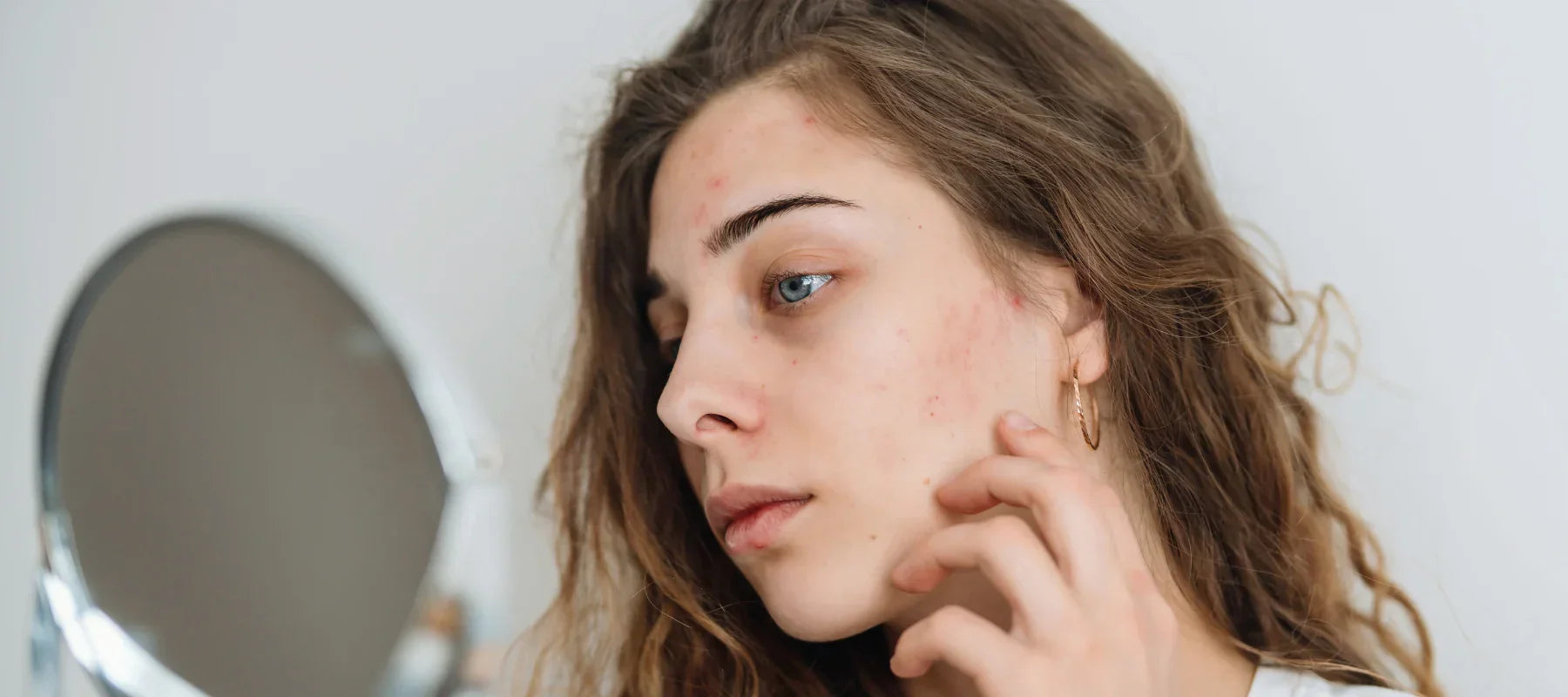 Effects of hard water on skin