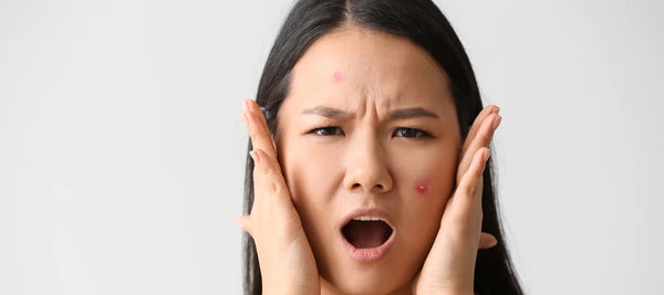 How pimples form on the face