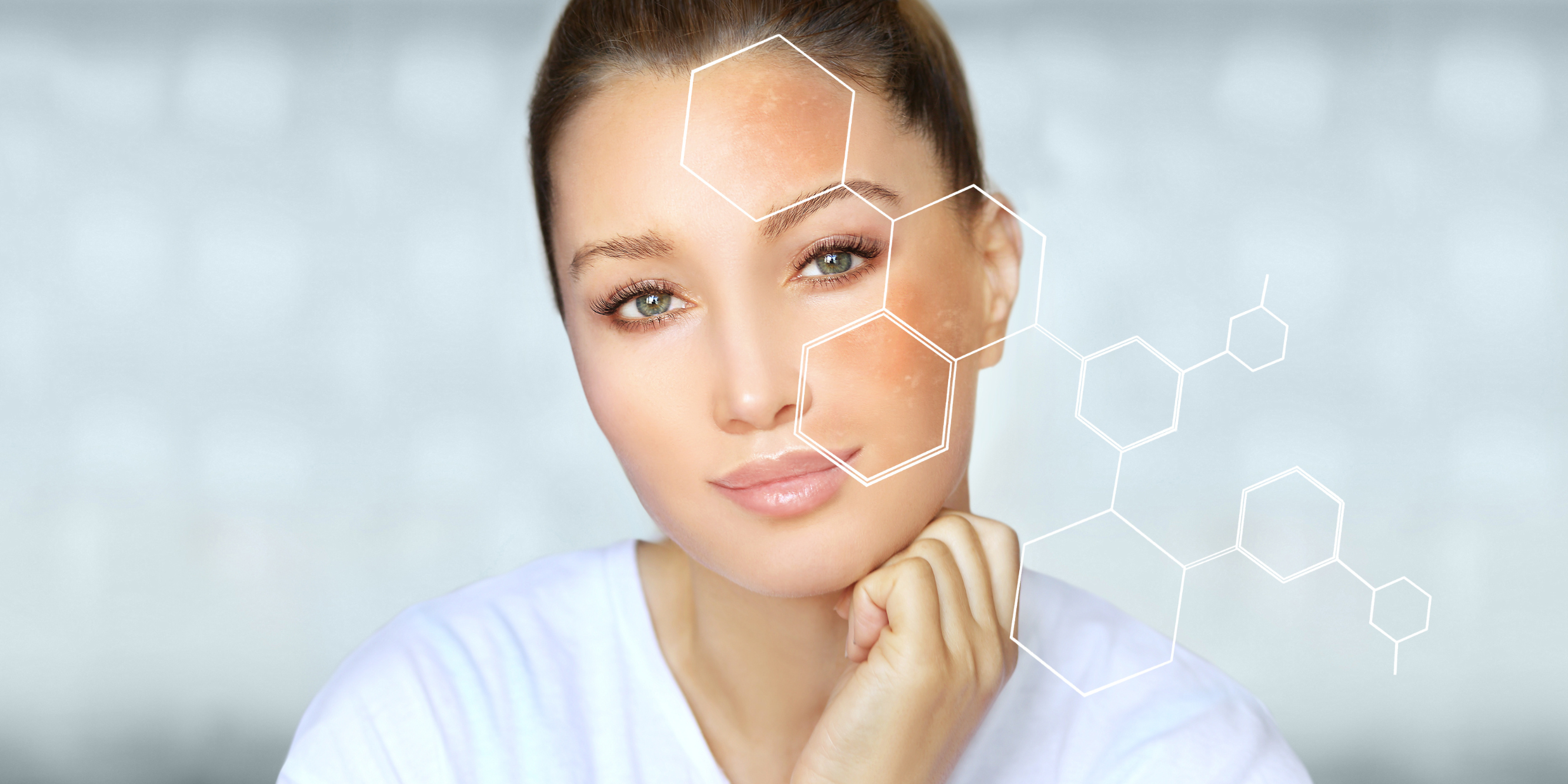 How To Reduce Melanin In Skin
