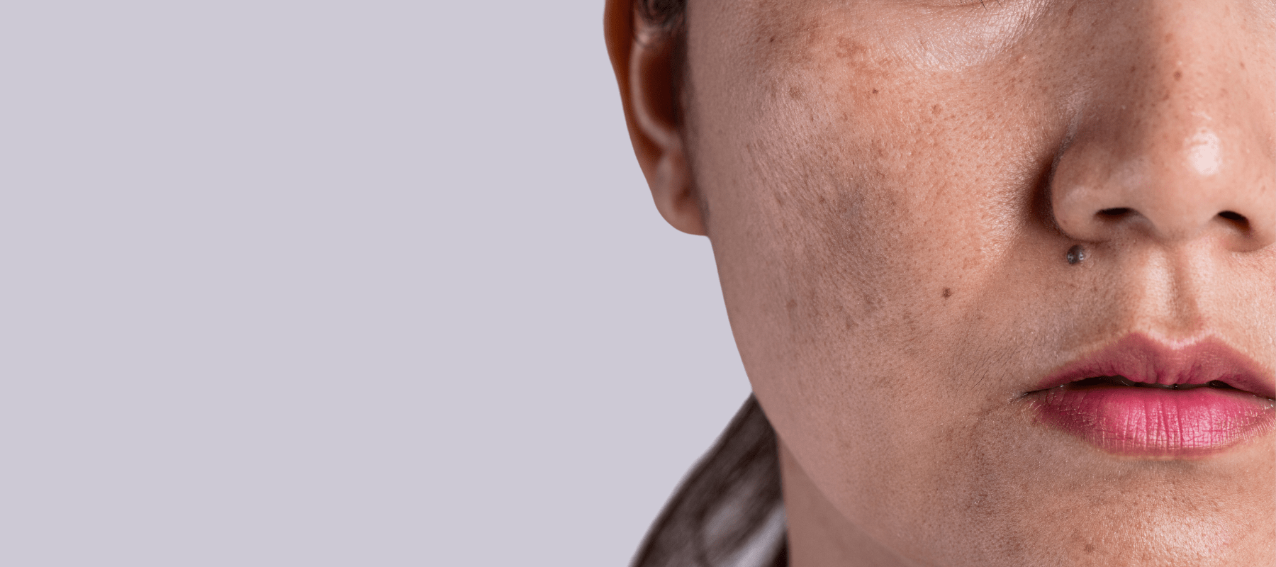 how to reduce skin pigmentation on face