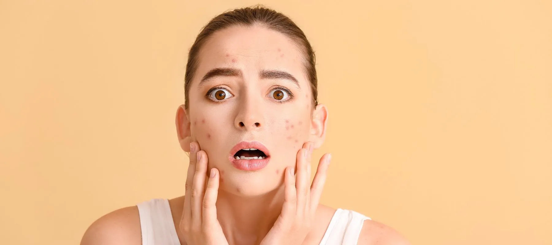 Irritated skin