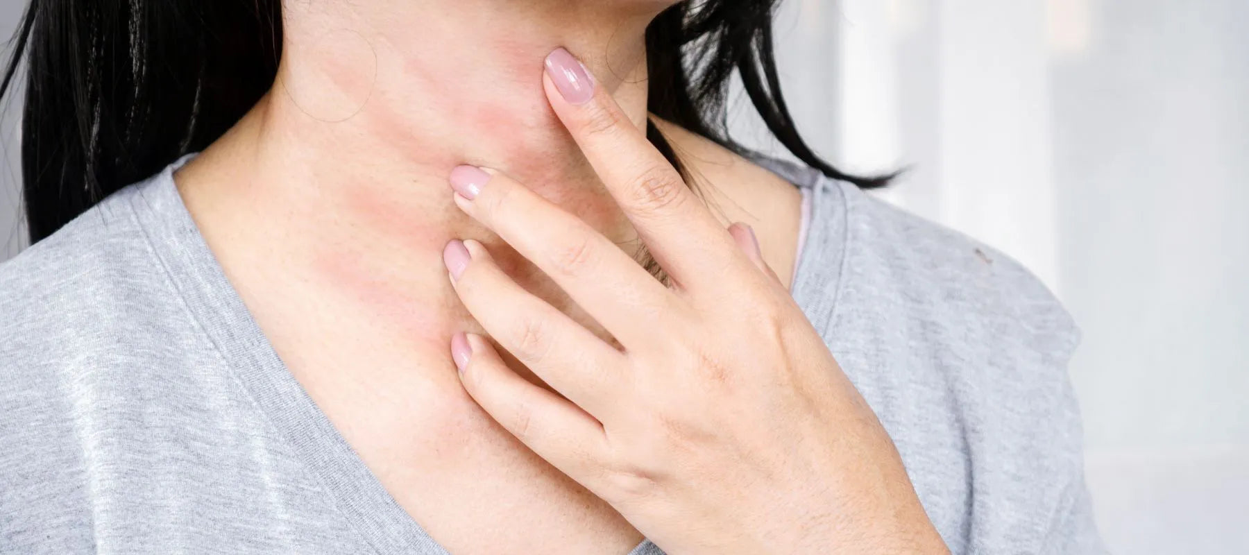 Itchy bumps on skin