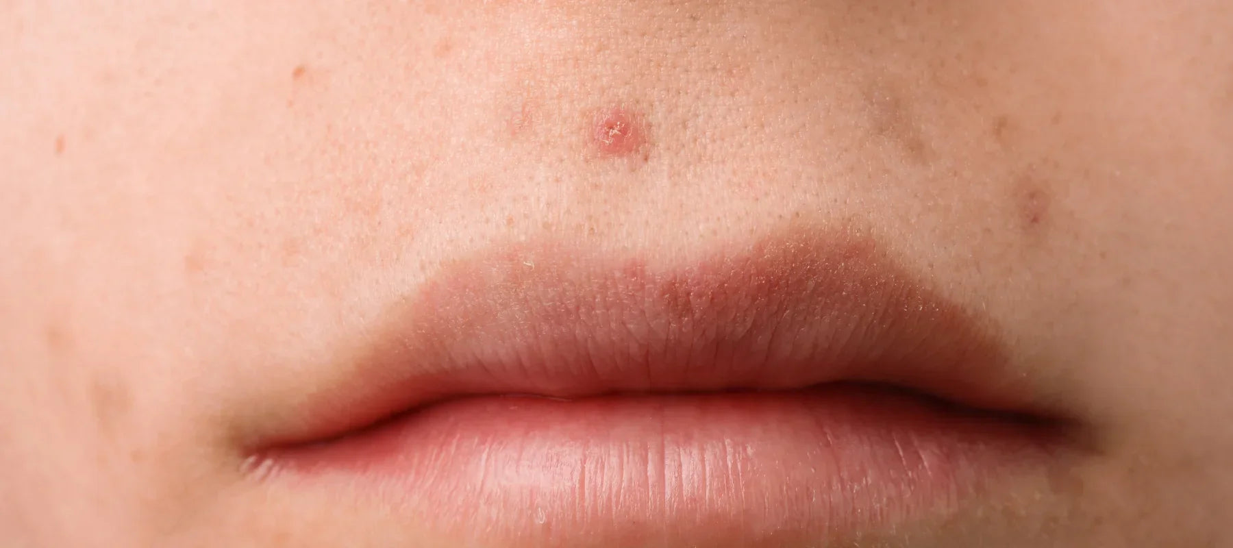 Red spots on face