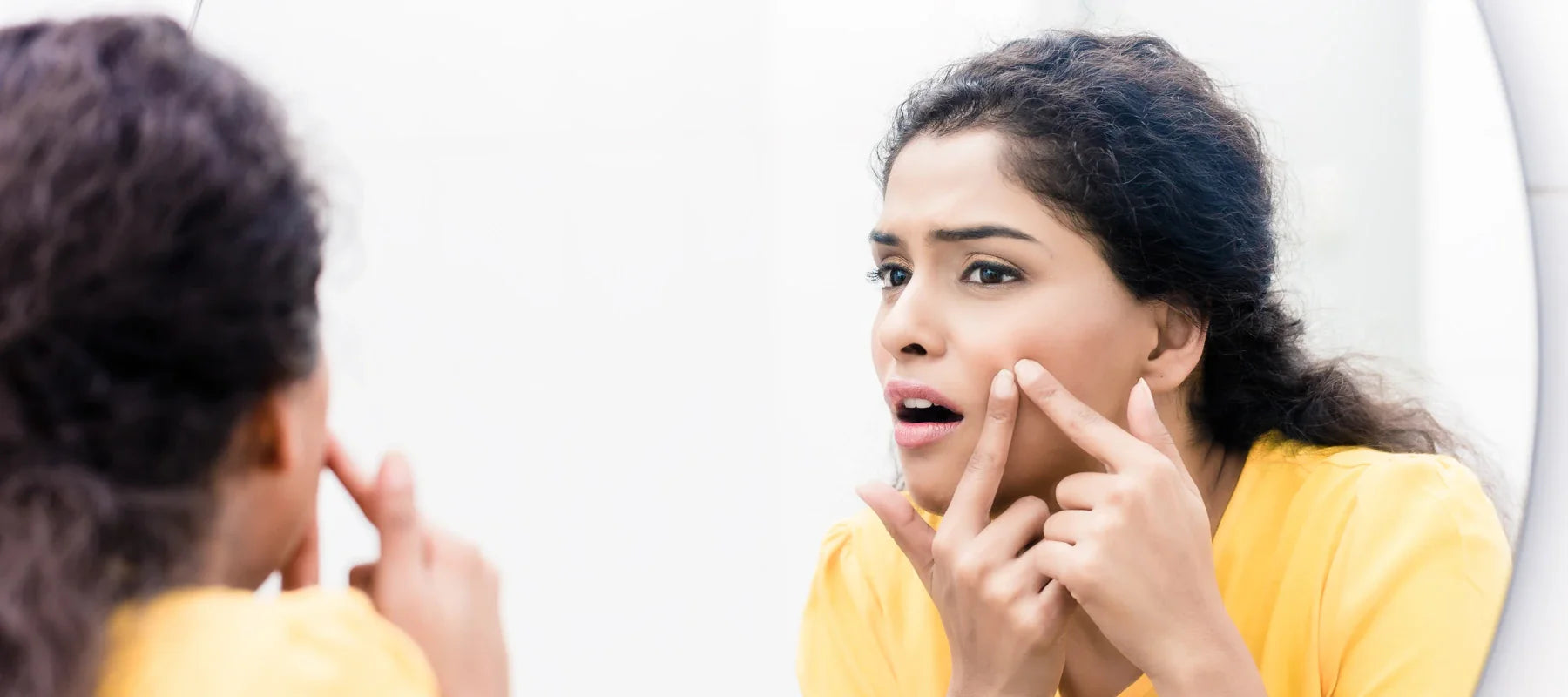 Guide to pimple self care