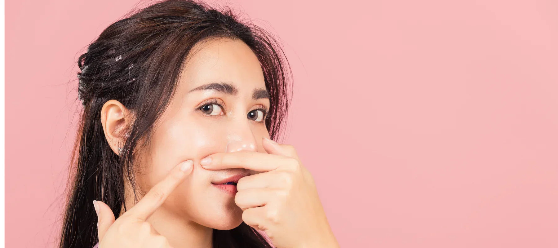 Salicylic acid for pimples
