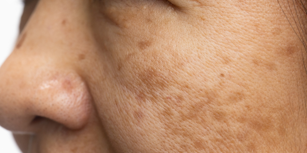 What Are Free Radicals & How Does It Impact Skin Health? | The Pink Foundry