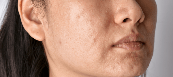 What are the causes of skin discoloration on face