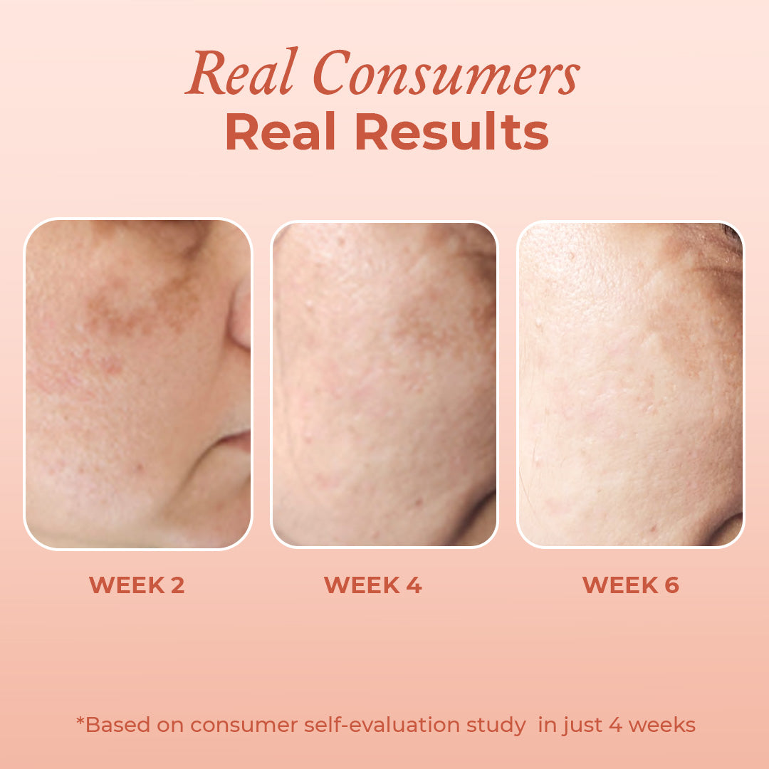 Acne + Pigmentation Relief Duo