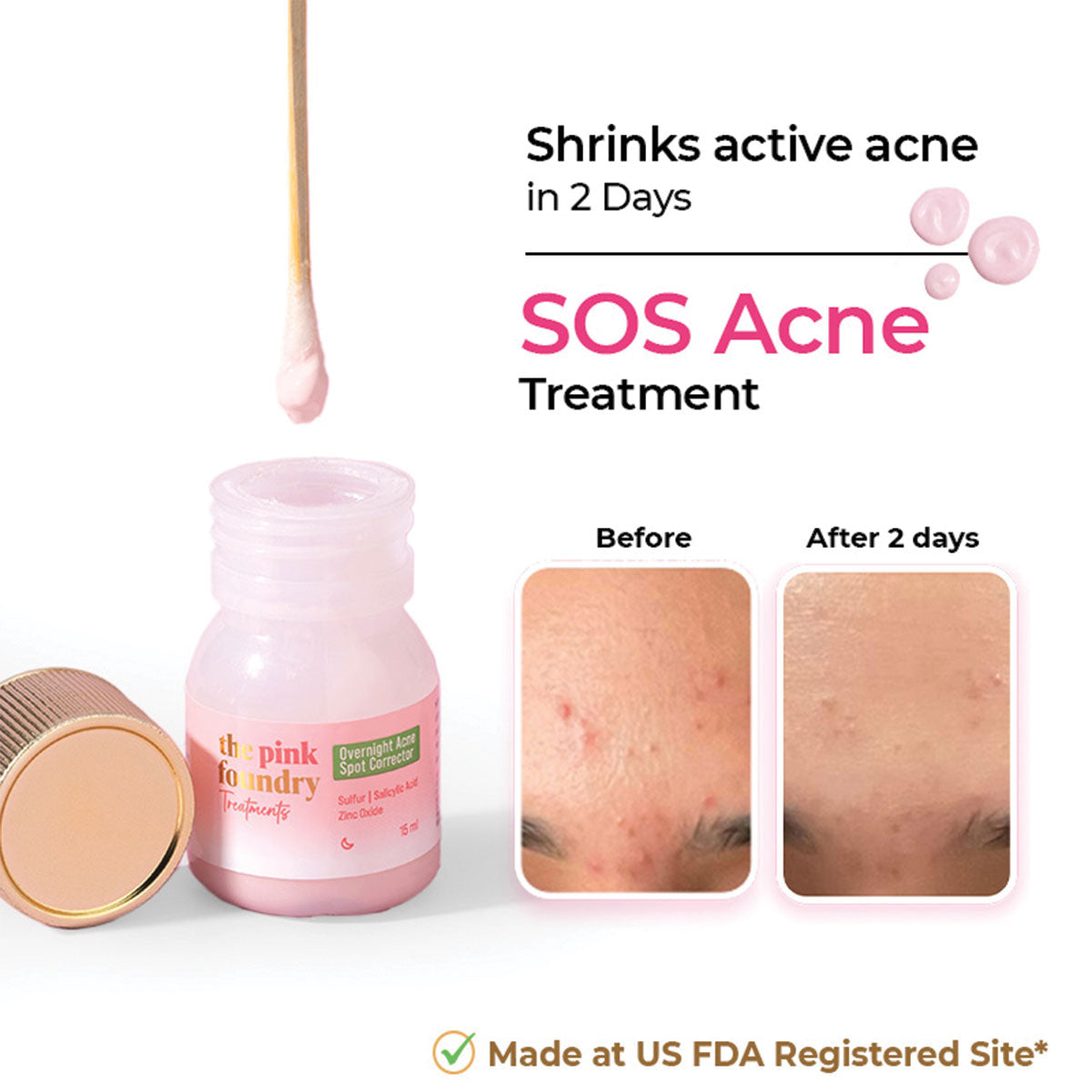 Overnight Acne Spot Corrector