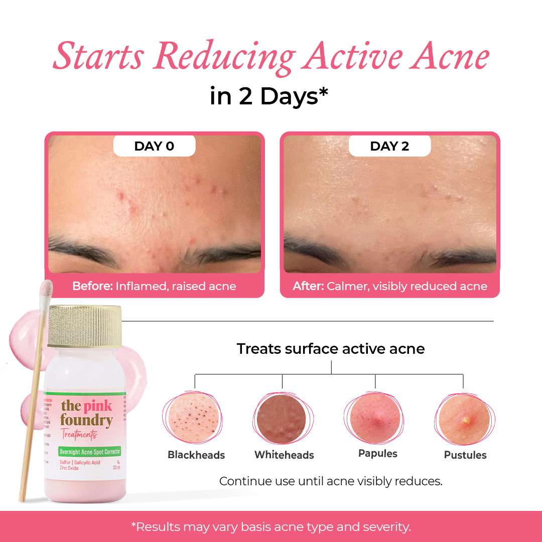 Overnight Acne Spot Corrector 30 ml
