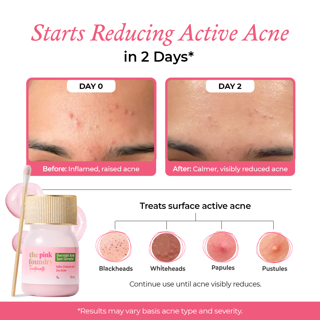 Overnight Acne Spot Corrector