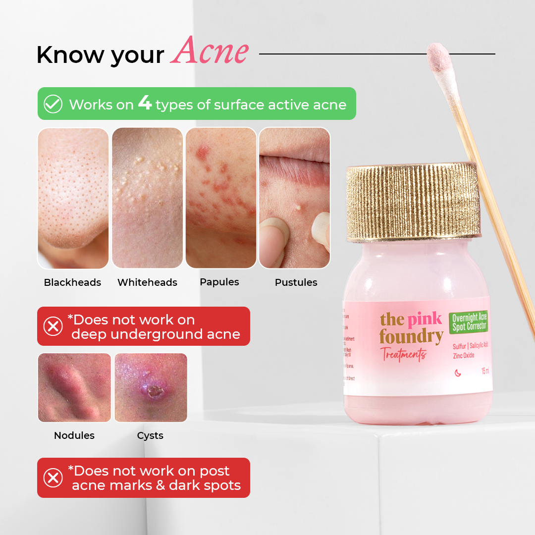 Overnight Acne Spot Corrector