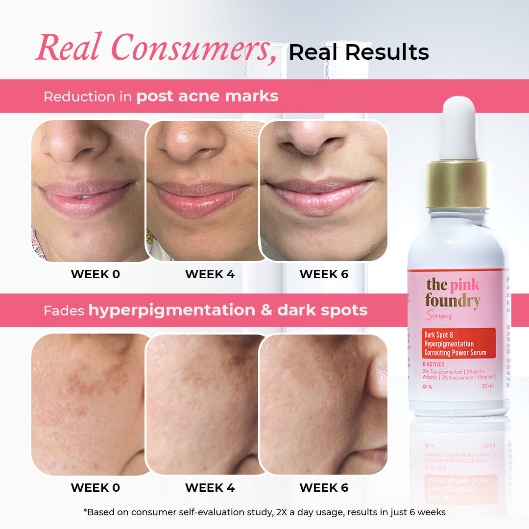 Dark Spot & Hyperpigmentation Correcting Power Serum