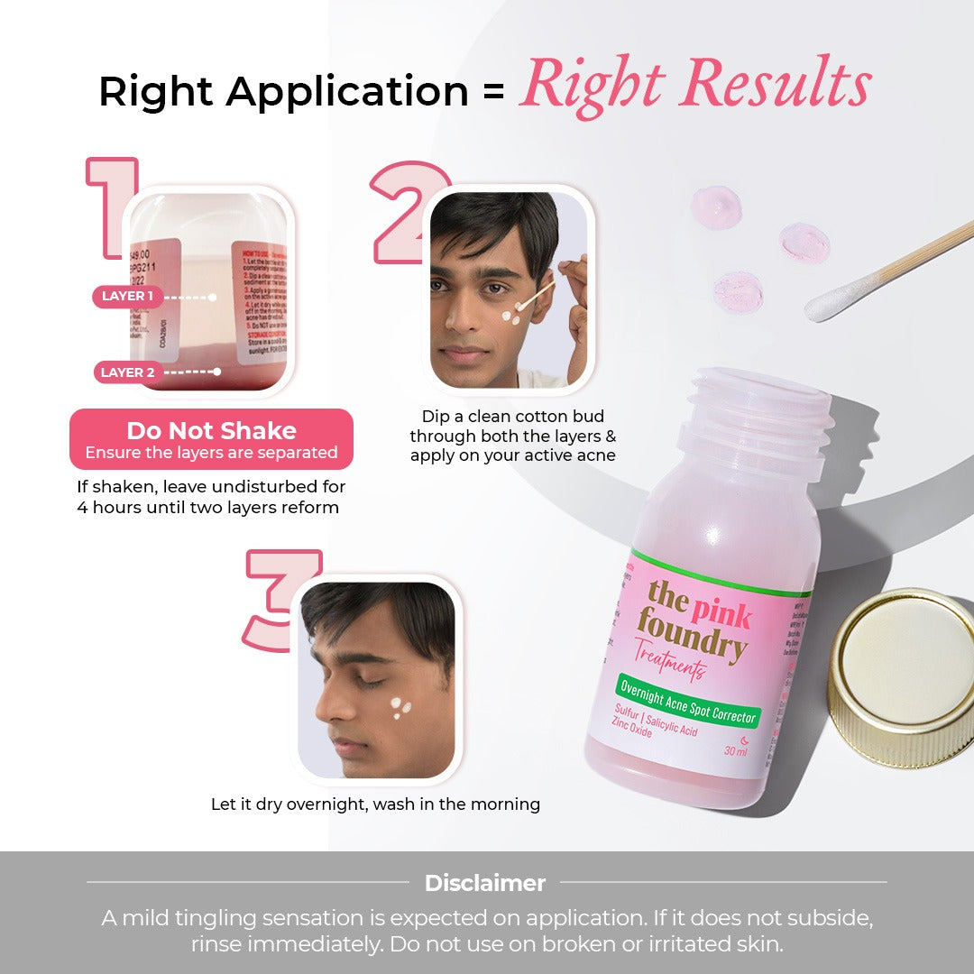 Overnight Acne Spot Corrector for Men