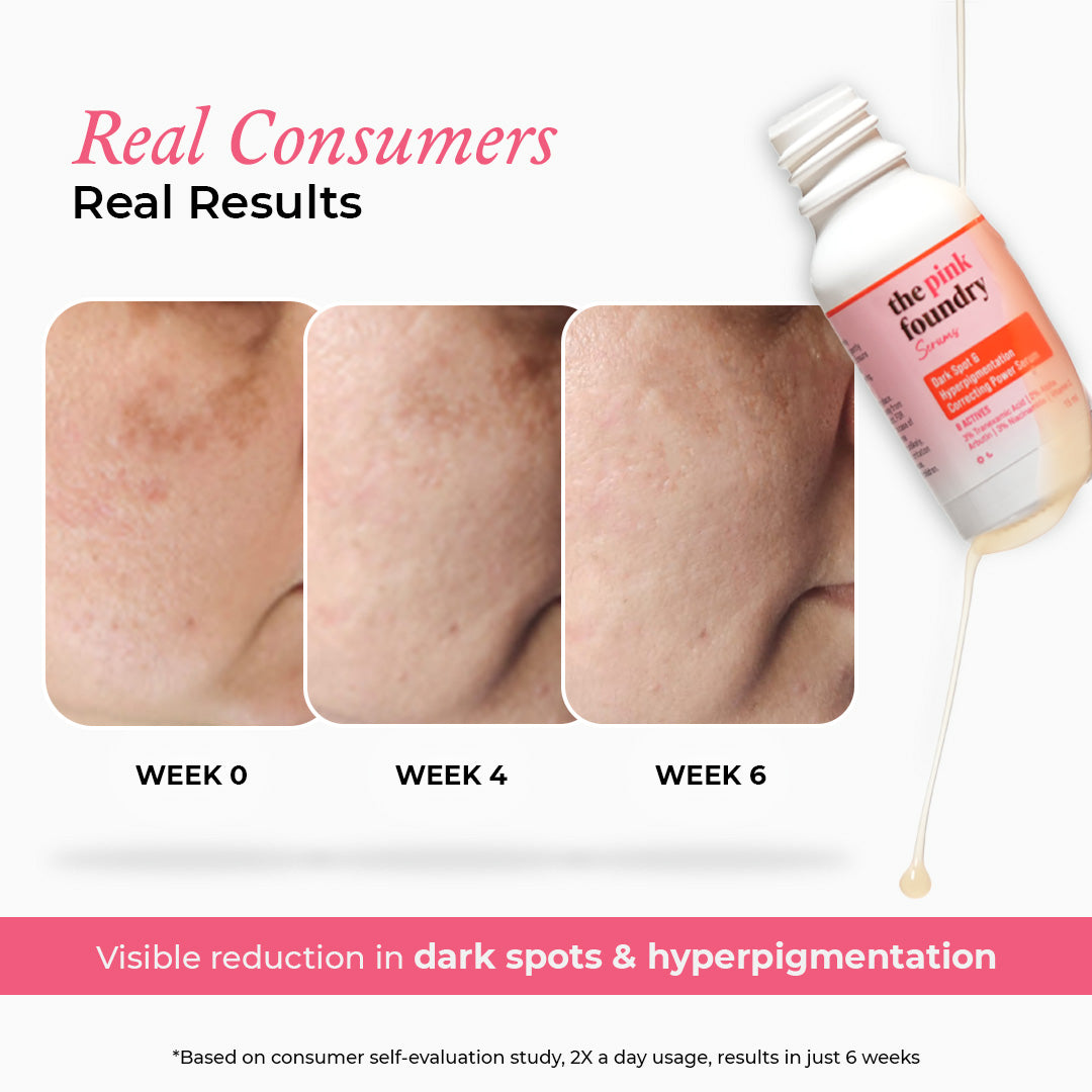 Mini Dark Spot & Hyperpigmentation Correcting Power Serum