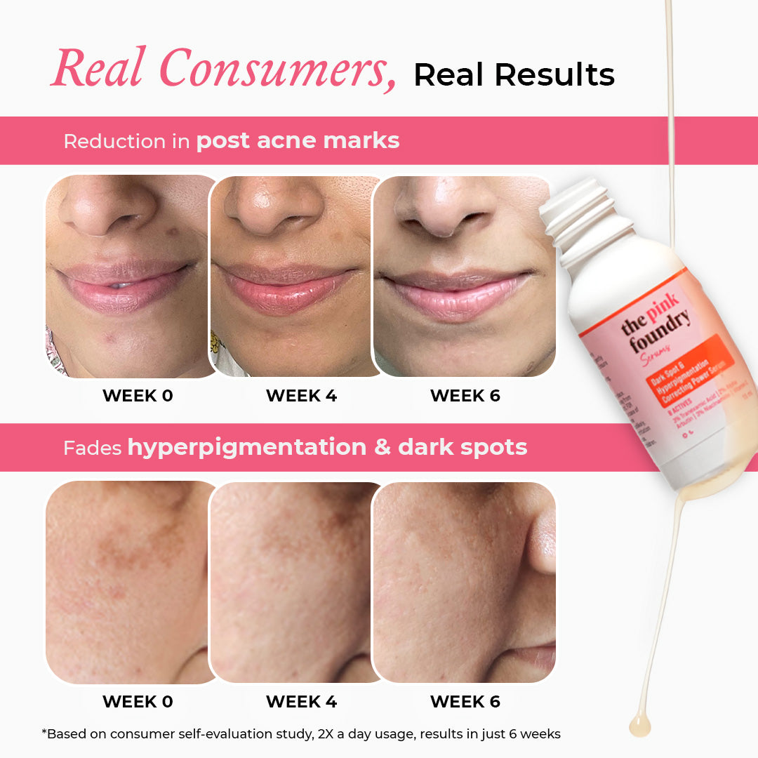 Mini Dark Spot & Hyperpigmentation Correcting Power Serum
