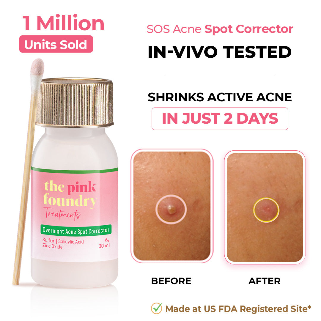 Overnight Acne Spot Corrector