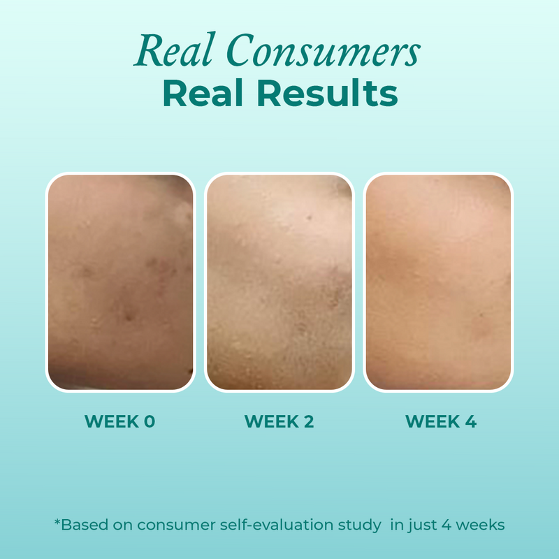 Consumer results after using the niacinamide serum by The Pink Foundry