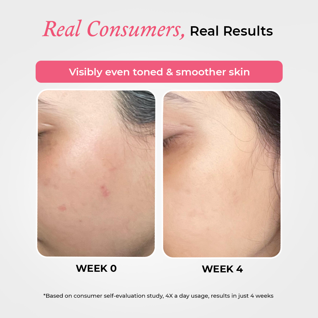 Super Clarifying 12% Niacinamide Face Serum